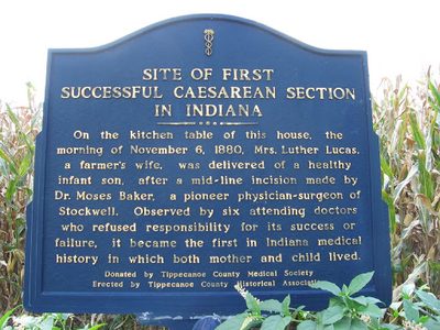 Site of First Successful Caesarean Section in Indiana